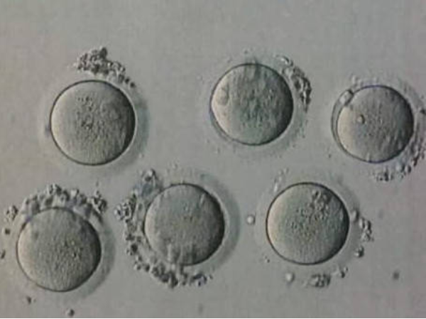19个胚胎多数是四级要当心！都有碎片养囊成功率真不高